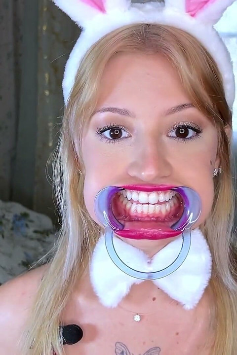 Mouth Retractor Teeth Examination