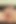 Masturbation