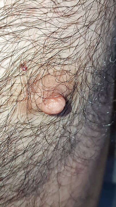 Male nipples in the foreground