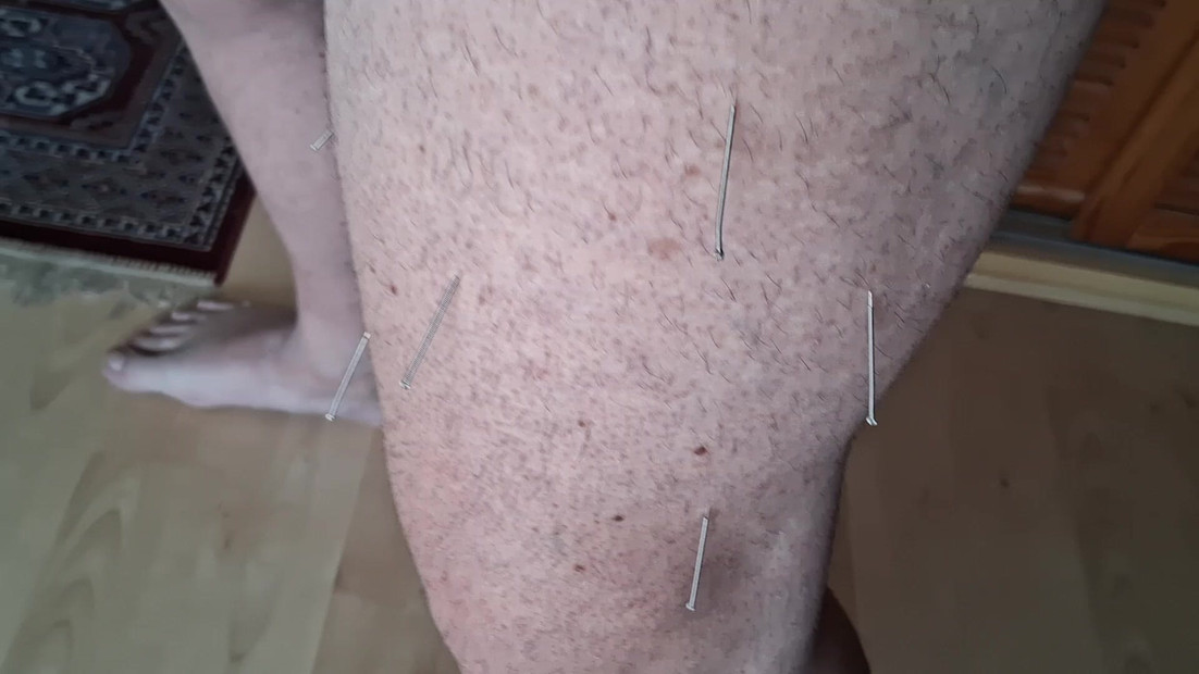 Needles