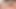 BBW with small dick with bladder catheter and swollen balls: he cums a lot!