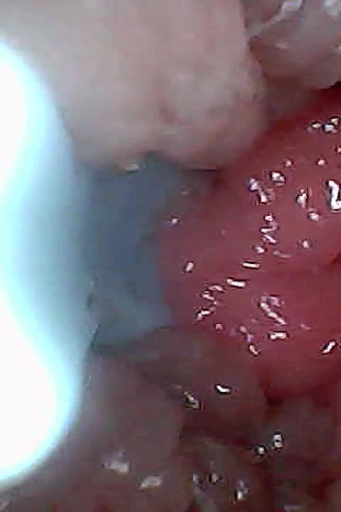 Guia Visual para Estimulação e Endoscopia de Ponto G