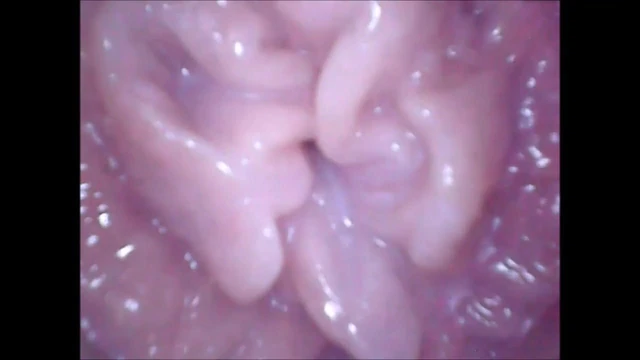 Cervix Cam