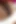 Huge Stretched Asshole and Pussy! Cervix, Gape, Rosebutt!