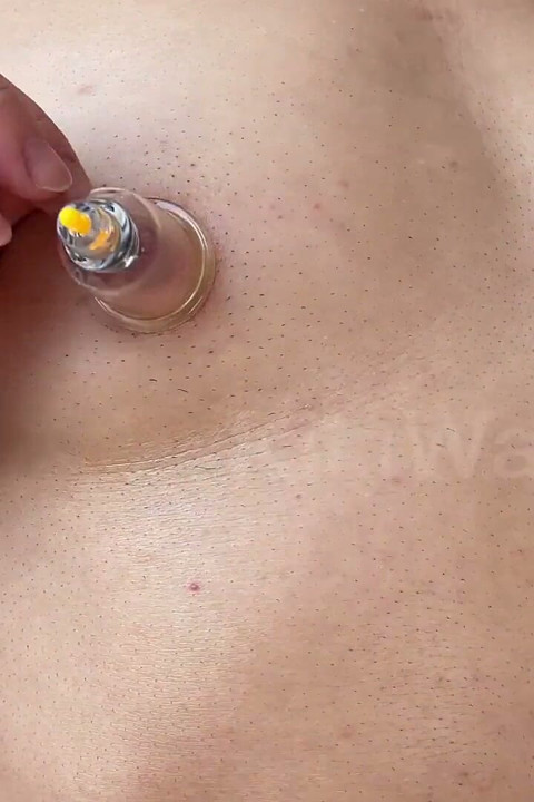 Asian Ftm Oiled Closeup Nipple Pussy Pumping and Cupping