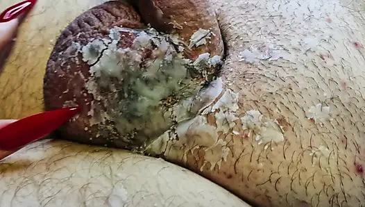 Heißes kerzenwachs gießt großzügig auf die eier und den schwanz des BDSM-Sklaven. CBT-wachsspiele für männliche genitalien