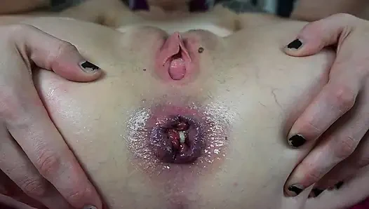 JOI Anal Prolapse and Gape