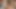 プライベートナースの訪問訪問 - 脈打つペニスの治癒