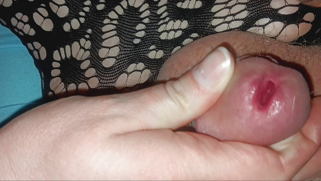 Hubby gets the works but not relief