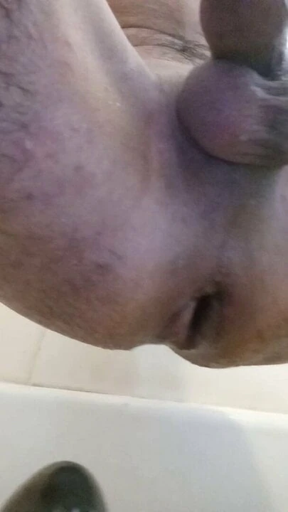 Anal gape