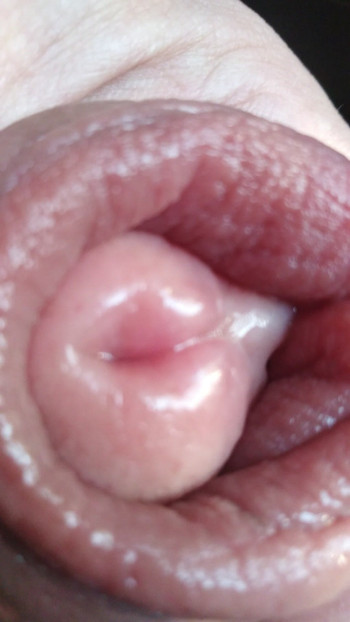 Pump3