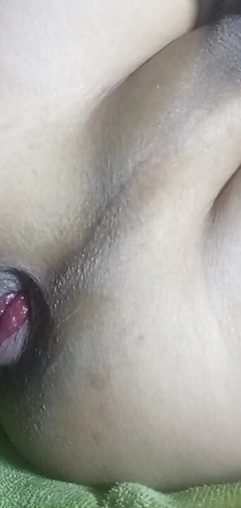 Hands-Free Anal Masturbation, Small Prolapse and Shoeing