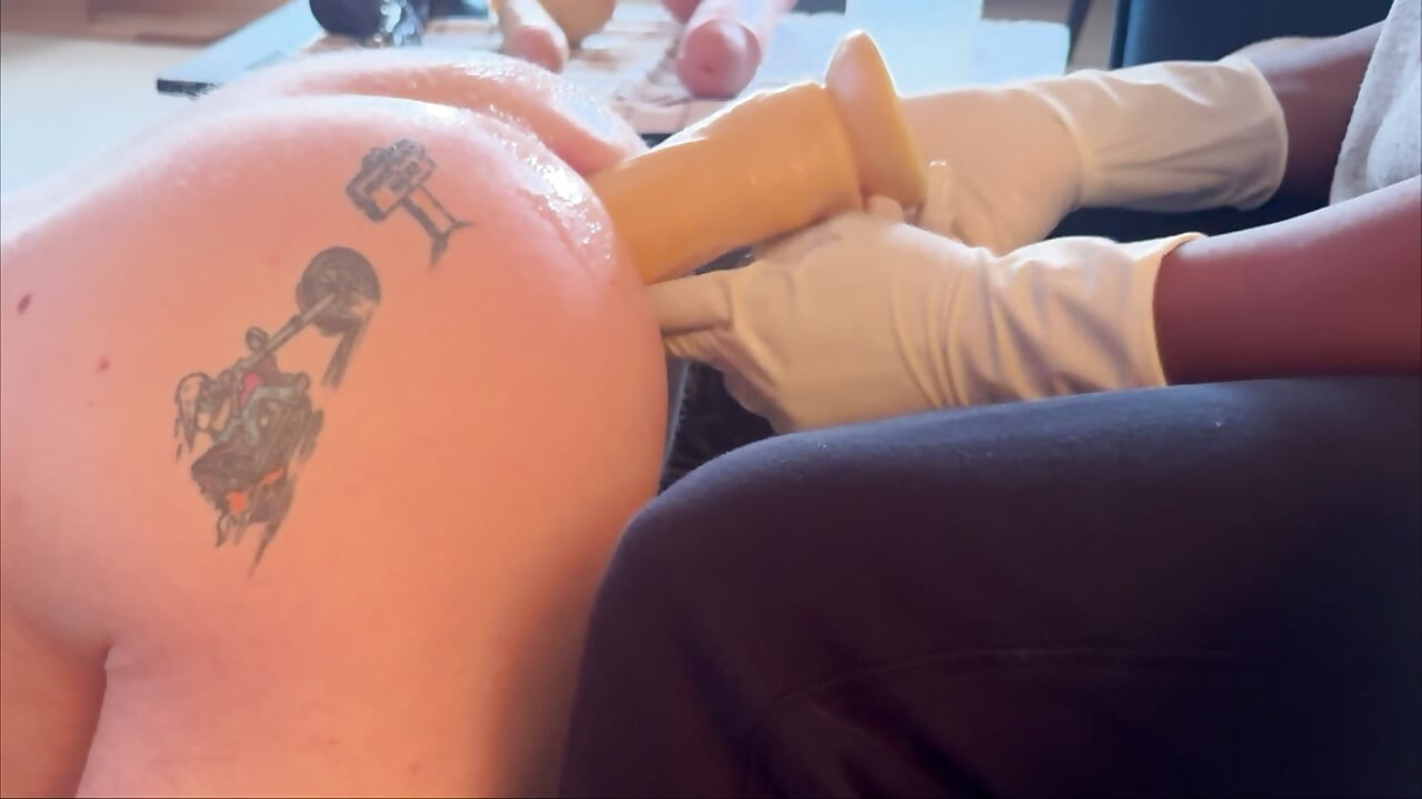 Estiramiento anal doloroso