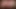 Hairy Cock In Sexy Underwear (Episode 3 - Now With Better Image Quality)