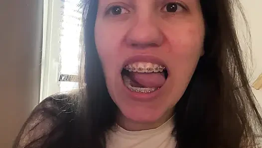 Menjilati kawat gigi dengan lidah Anda