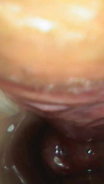 Endoscope Examination of my Pussy and Cervix