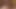 Manila Cherry Popping young Asian cherries Amateur babes