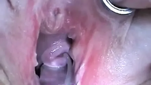 Cum Injection with Syringe in Cervix Uterus after Fucking