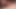 Penis Pump part4 26.02.2019