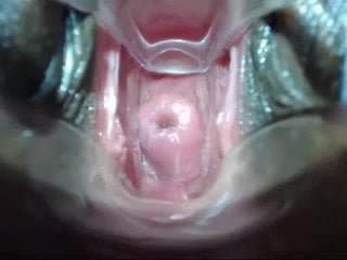 Penetração rasa do colo do útero