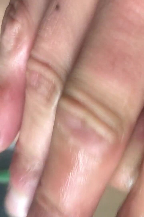 Spermaxl