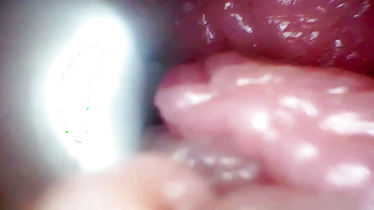 Endoscope Camera Records My Wife's G Spot. Educational Video Close up