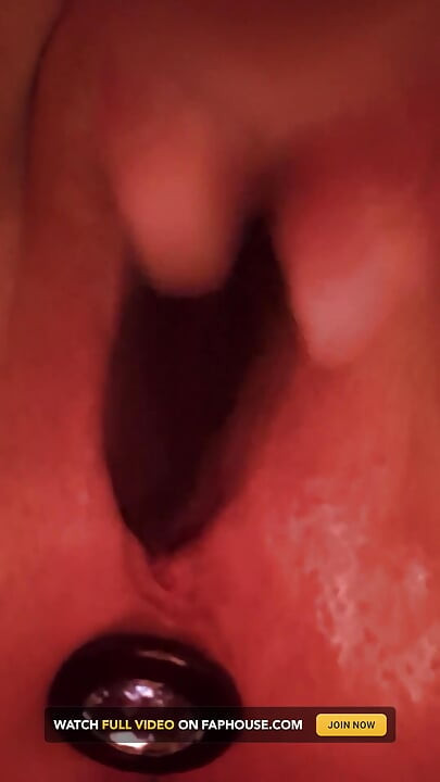 Analplug