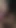 Submissive wife, fisting, fruit insertion and anal