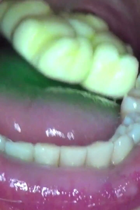 Swallowing Gummy Bears in Pairs!!