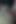 Stretched Pumped Pussy Pissing Close up 1