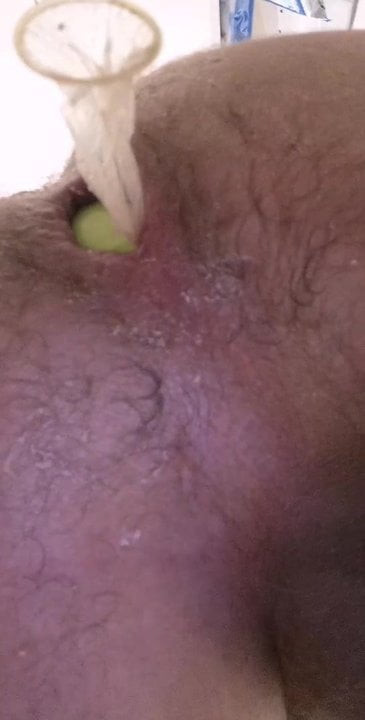 Anal stretching