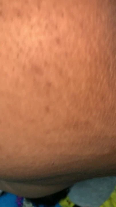 Gaping hole