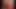 Fetish-Concept.com: - Selbstbefriedigung mit 2 Gipsbeinen -