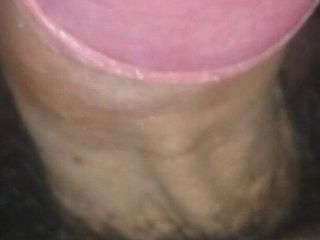 19-year-old boy's penis with a pink head