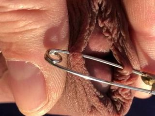 Safety pin in foreskin