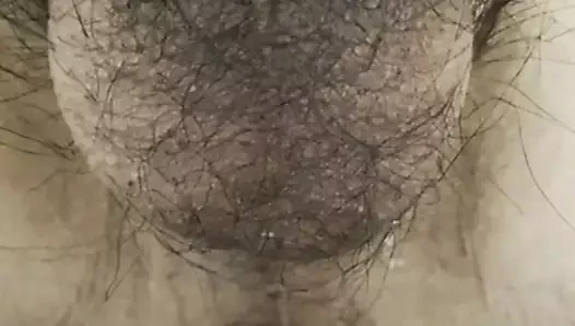 anal