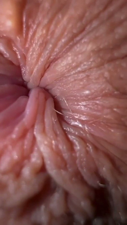 THE NEIGHBOR GIRL IS ALREADY 18 YEARS OLD. Her anus is constantly itchy. What the fuck should I do? | Clip 1