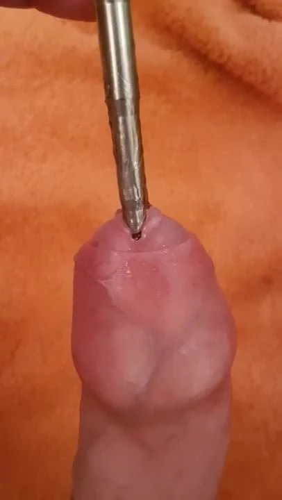 Urethral Sounding