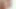 Lizzy Yum november 2023 anal masturbation #1 Post Op Orgasm Pussy anal toys