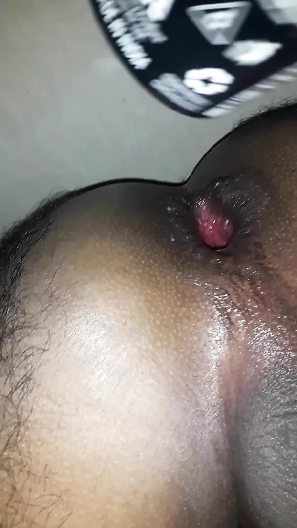Kerala boy bottle insertion in asshole