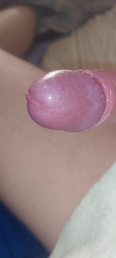 Iconic moment from "This sissy Uncut virgin dick needs Cage"