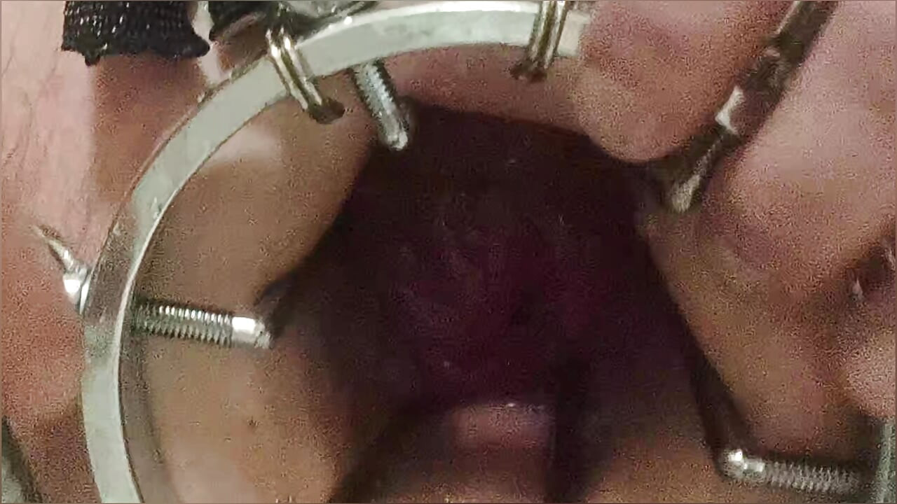 浣腸、アナルシャワー。アナルミラー越しのクローズアップ映像。水を使ったアナル。肛門に水を入れる