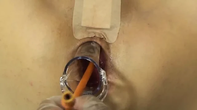Elmer's Wife Anal fisting speculum 4