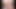 Pakistani Desi Gay boy fingered himself and found anal fissure after Fingering