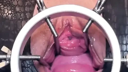 Showing Off My Pumped Cervix