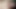 Bbw anal gerçekten acıyor