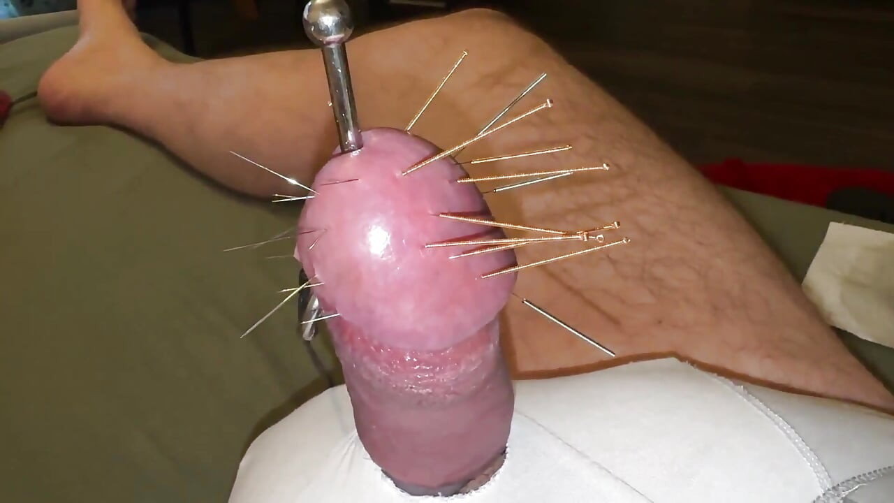 Acupuncture - Orgasm!