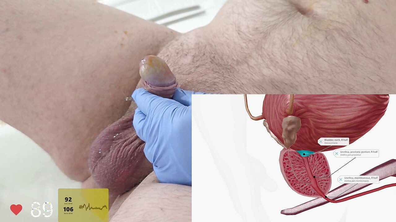 A doua oară încerc sondarea uretrală și revedem anatomia