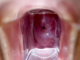 Stella St. Rose - Visões extremas do colo do útero e sucos fluindo usando um espéculo