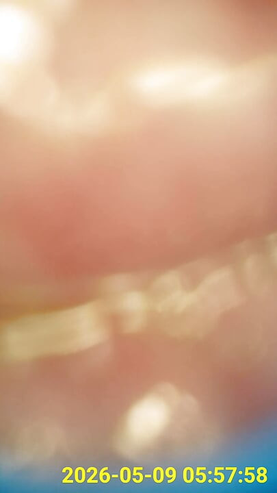 Close up of buttplug & HD Endoscope insertion